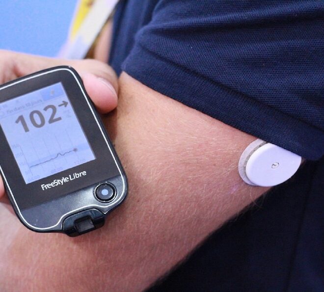 Monitoreo de glucosa en sangre